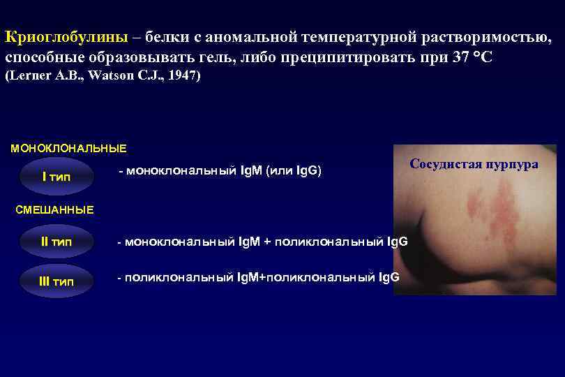 Криоглобулины – белки с аномальной температурной растворимостью, способные образовывать гель, либо преципитировать при 37