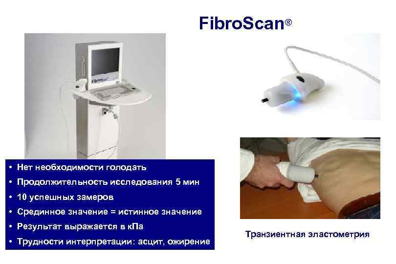 Fibro. Scan® • Нет необходимости голодать • Продолжительность исследования 5 мин • 10 успешных