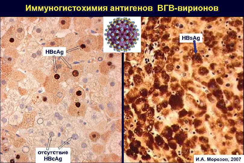 Иммуногистохимические методы презентация