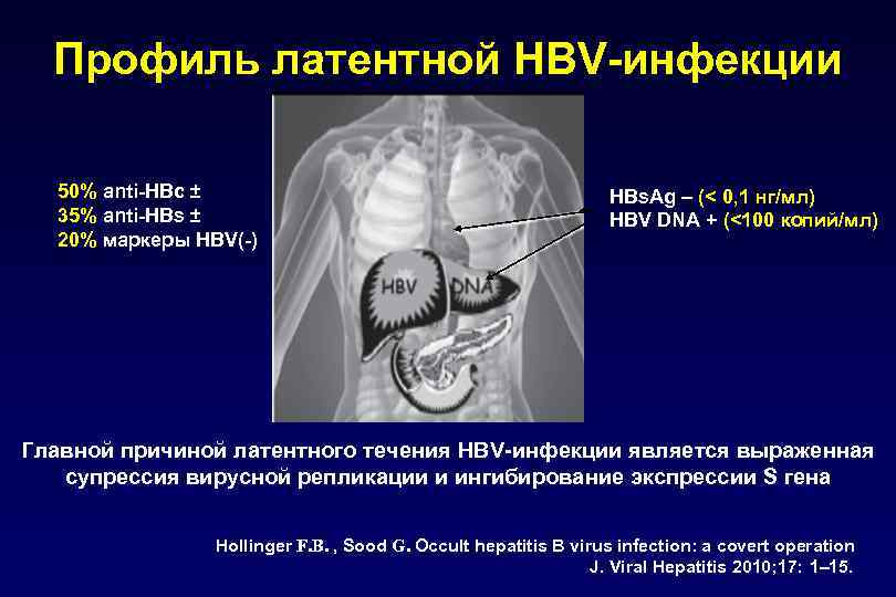 Профиль латентной HBV-инфекции 50% аnti-HBc ± 35% anti-HBs ± 20% маркеры HBV(-) HBs. Ag