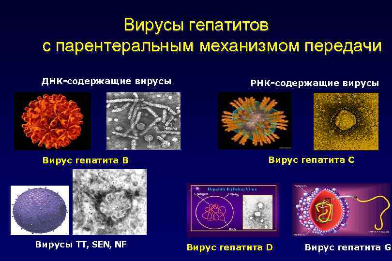 Вирусы гепатитов с парентеральным механизмом передачи ДНК-содержащие вирусы Вирус гепатита В Вирусы TT, SEN,