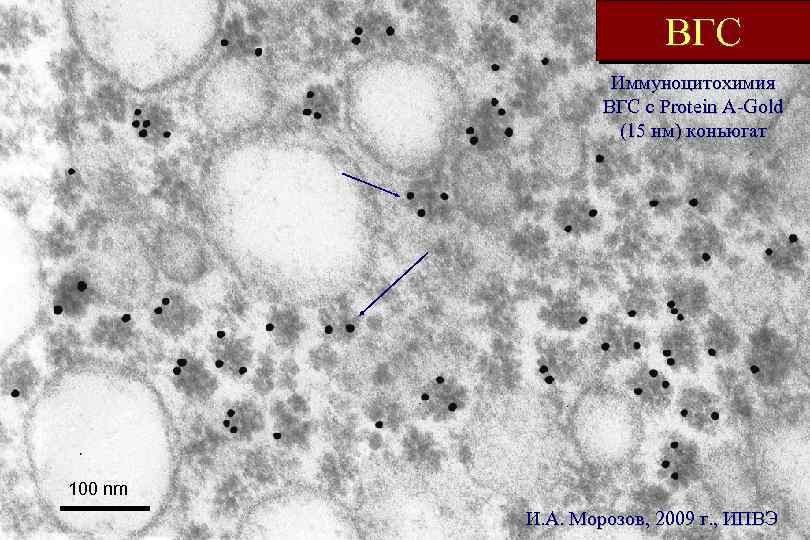 ВГС Иммуноцитохимия ВГС с Protein A-Gold (15 нм) коньюгат 100 nm И. А. Морозов,