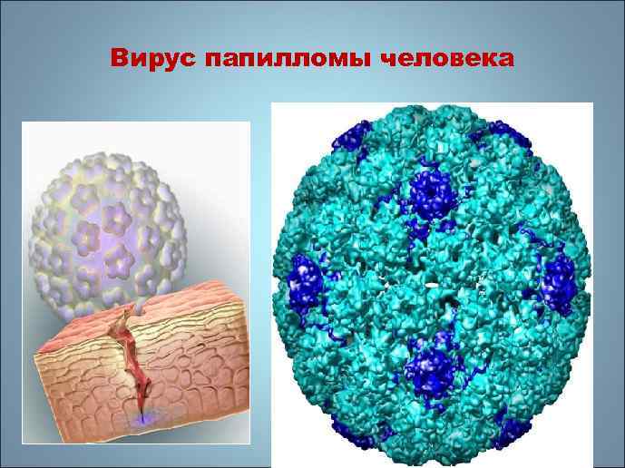 Вирус папилломы человека 