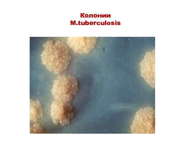 Колонии M. tuberculosis 