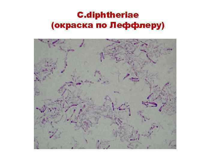 C. diphtheriae (окраска по Леффлеру) 