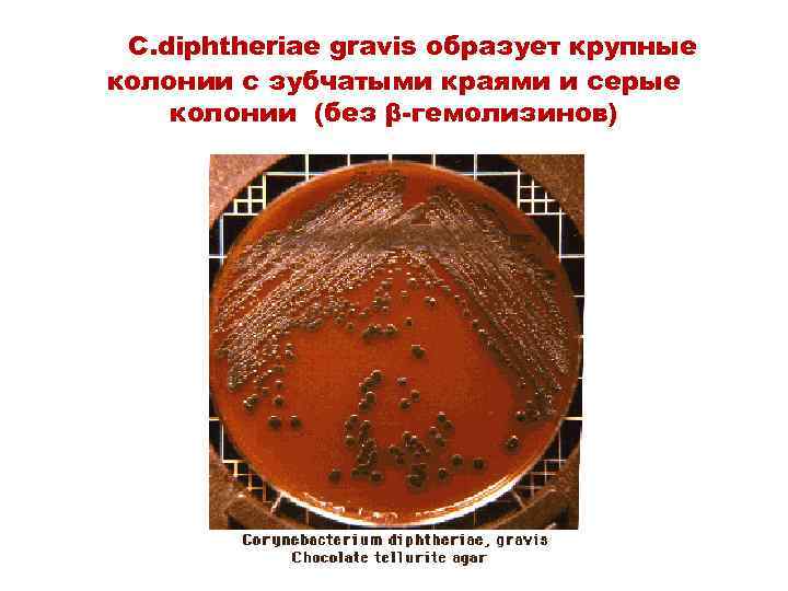 C. diphtheriae gravis образует крупные колонии с зубчатыми краями и серые колонии (без β-гемолизинов)