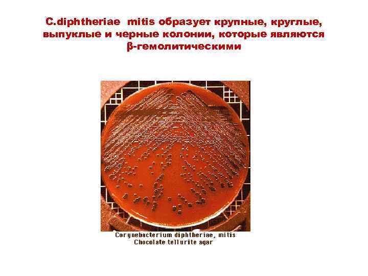 C. diphtheriae mitis образует крупные, круглые, m выпуклые и черные колонии, которые являются β-гемолитическими