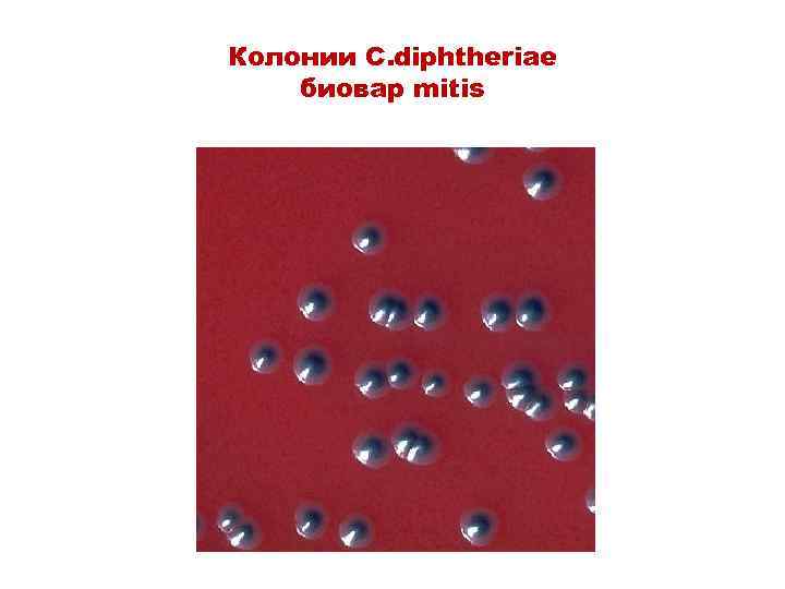 Колонии C. diphtheriae биовар mitis 