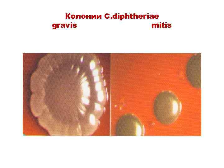 Колонии C. diphtheriae gravis mitis 