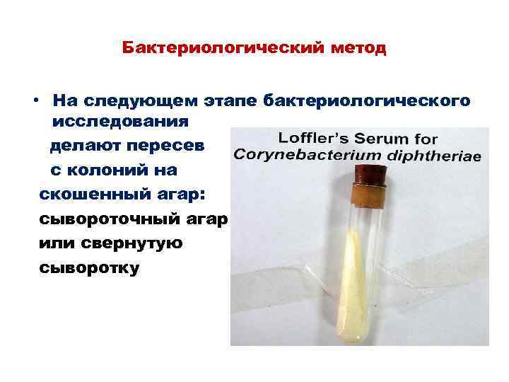 Бактериологический метод • На следующем этапе бактериологического исследования делают пересев с колоний на скошенный
