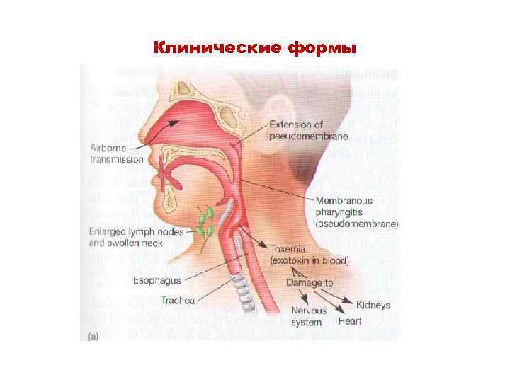 Клинические формы 