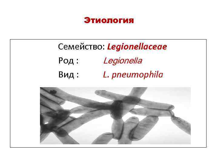 Этиология Семейство: Legionellaceae Род : Legionella Вид : L. pneumophila 