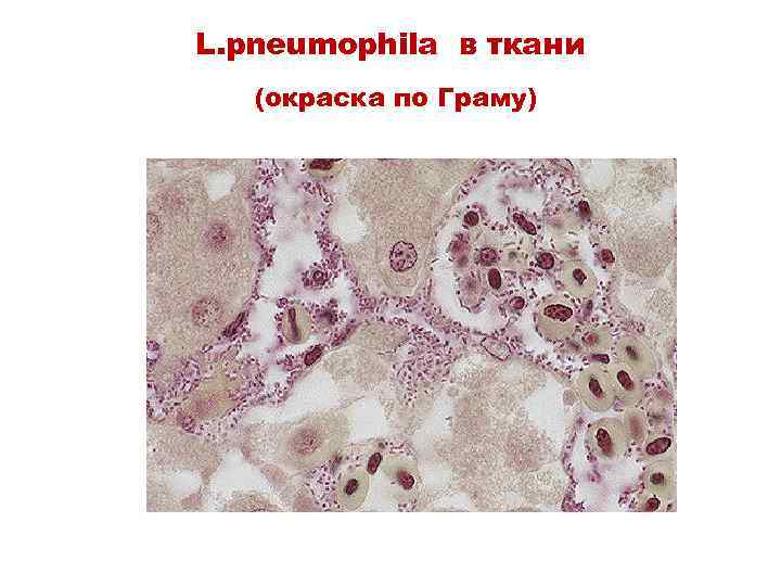 L. pneumophila в ткани (окраска по Граму) 