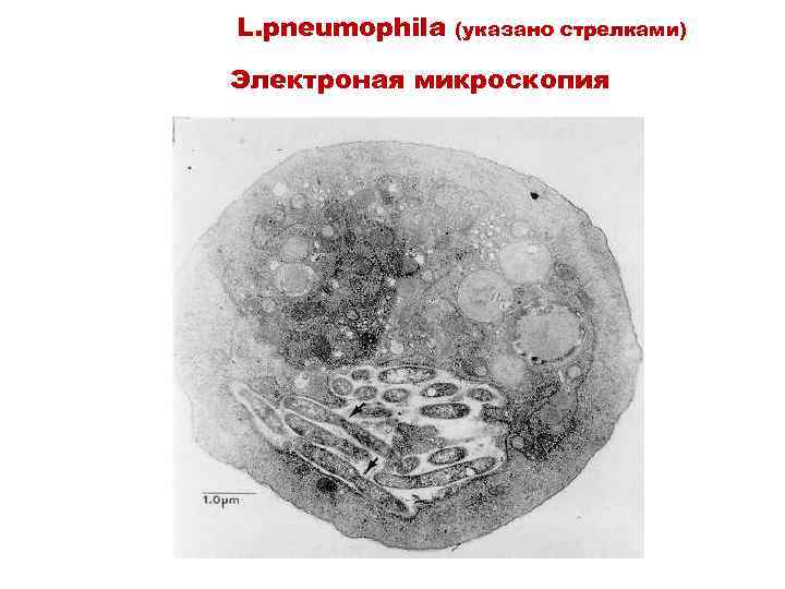 L. pneumophila (указано стрелками) Электроная микроскопия 