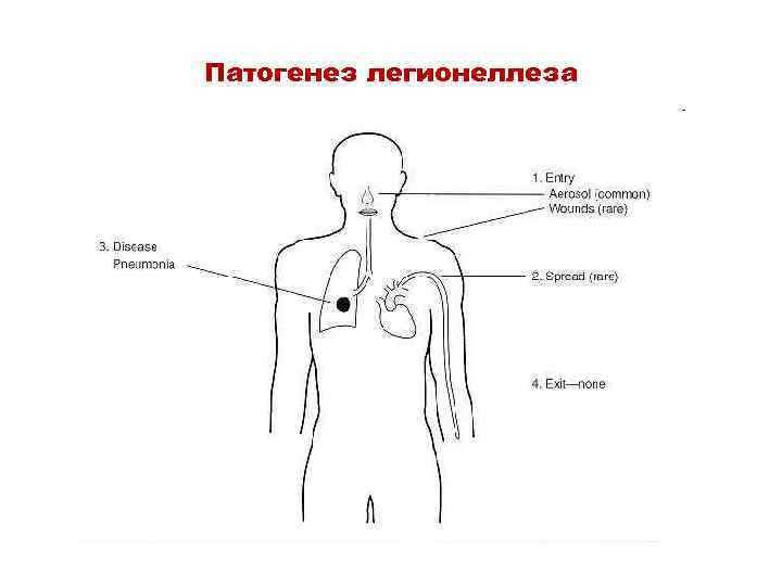 Патогенез легионеллеза 