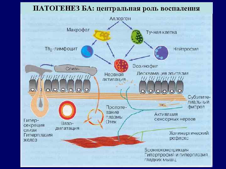 ПАТОГЕНЕЗ БА: центральная роль воспаления 