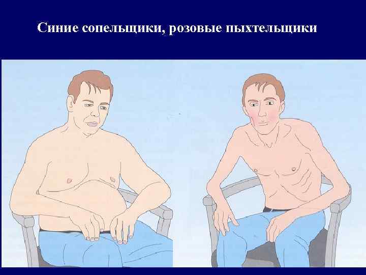 Синие сопельщики, розовые пыхтельщики 