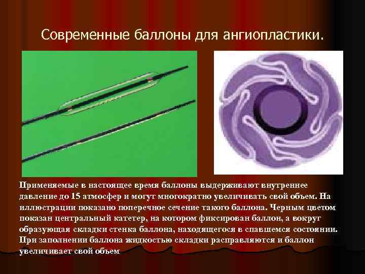 Современные баллоны для ангиопластики. Применяемые в настоящее время баллоны выдерживают внутреннее давление до 15