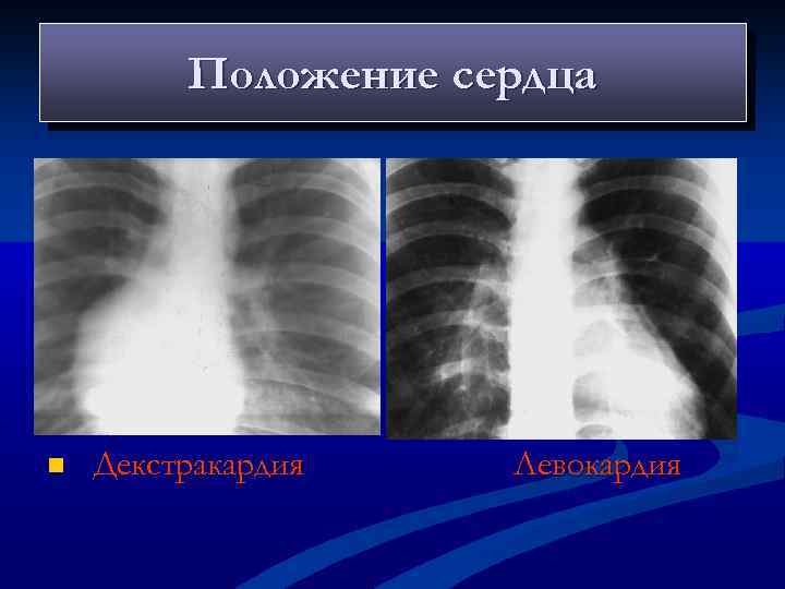 Лучевая диагностика в оториноларингологии и офтальмологии презентация