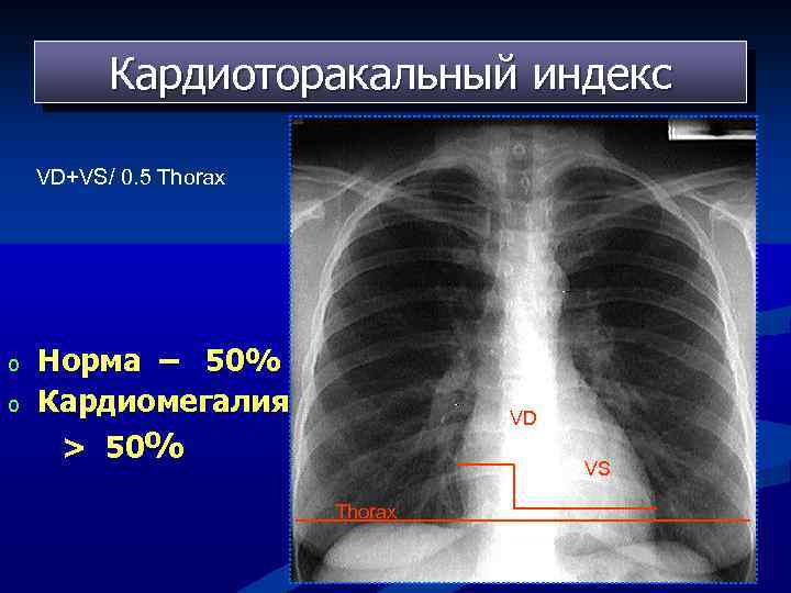 Что такое смад в кардиологии фото