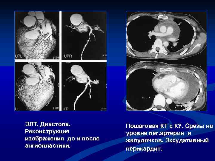 Диастола и с стола