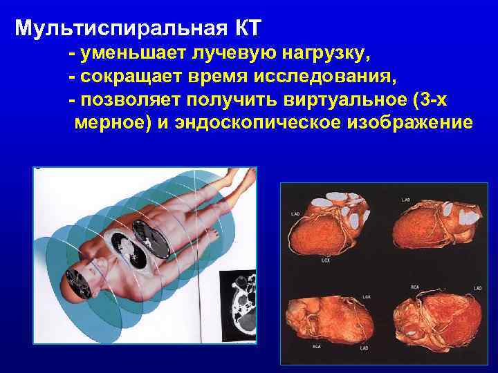 Лучевая диагностика средостения презентация