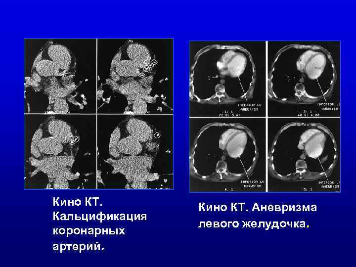 Лучевая диагностика в оториноларингологии и офтальмологии презентация