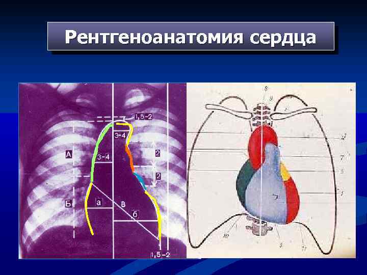 Понятие о дугах сердца рисунок