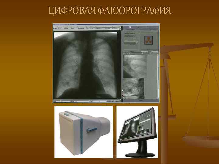 ЦИФРОВАЯ ФЛЮОРОГРАФИЯ 