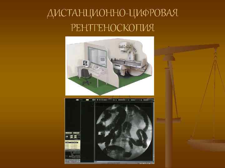 ДИСТАНЦИОННО-ЦИФРОВАЯ РЕНТГЕНОСКОПИЯ 