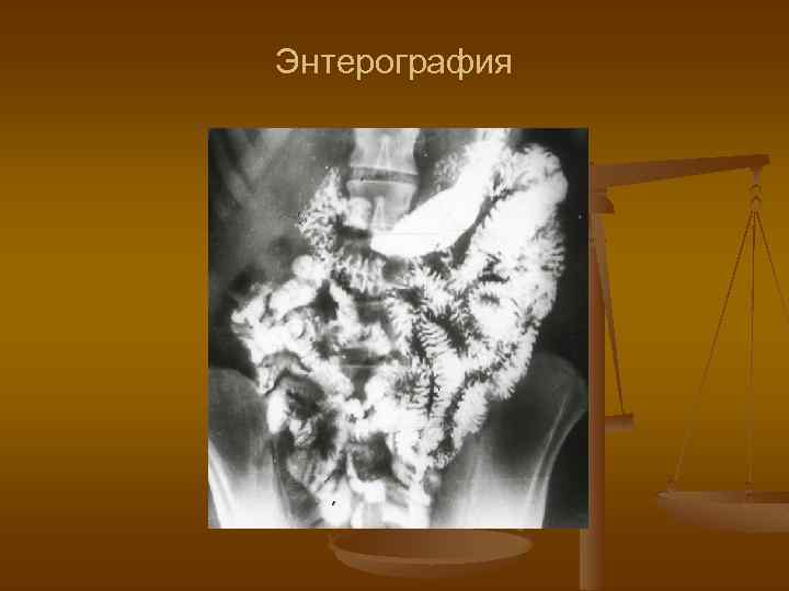 Энтерография 