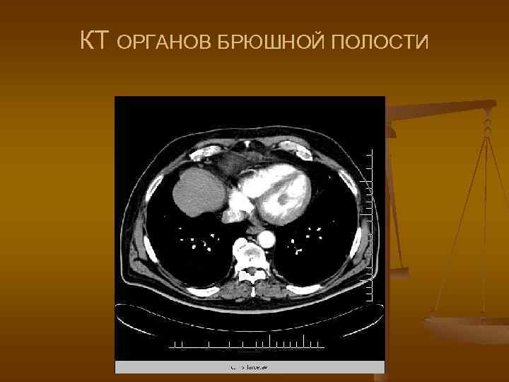 КТ ОРГАНОВ БРЮШНОЙ ПОЛОСТИ 