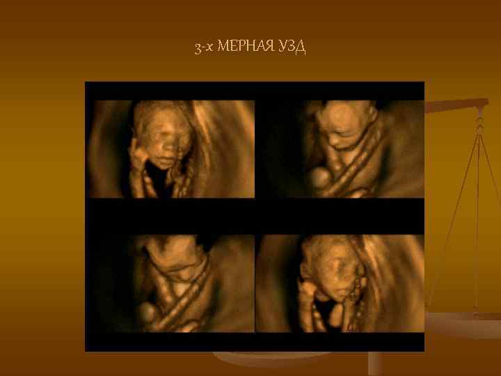 3 -х МЕРНАЯ УЗД 