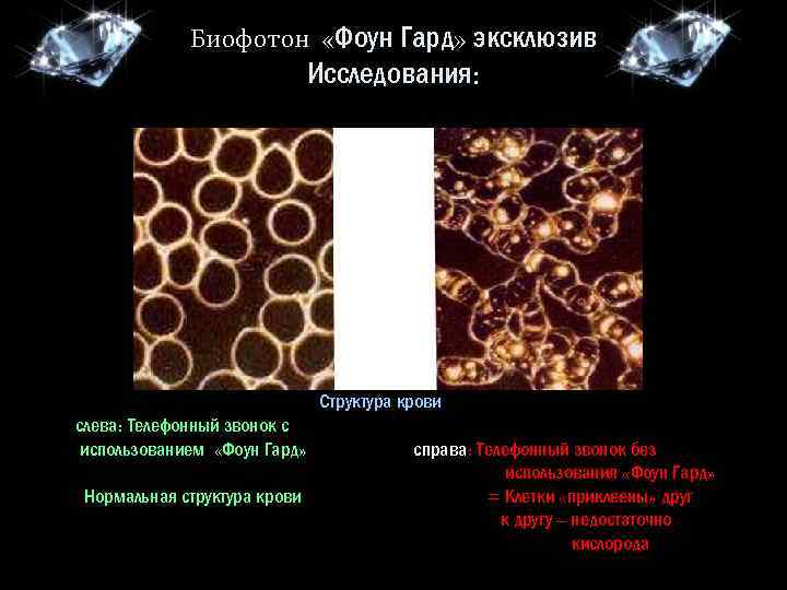 Биофотон «Фоун Гард» эксклюзив Исследования: Структура крови слева: Телефонный звонок с использованием «Фоун Гард»