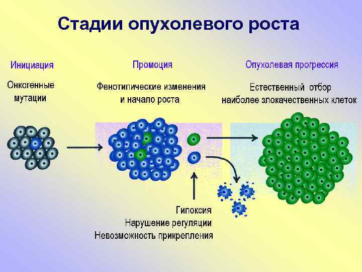 Стадии опухолевого роста 