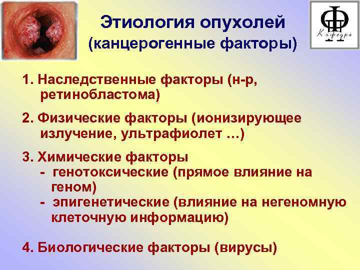Этиология опухолей (канцерогенные факторы) 1. Наследственные факторы (н-р, ретинобластома) 2. Физические факторы (ионизирующее излучение,