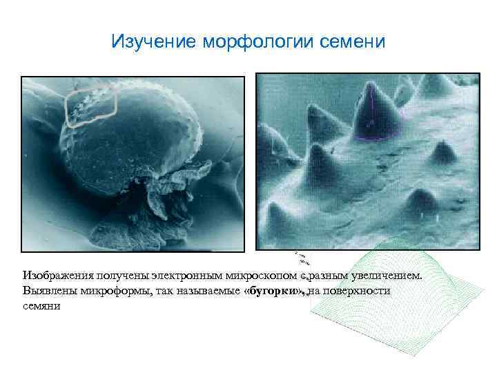 Изучение морфологии семени Изображения получены электронным микроскопом с разным увеличением. Выявлены микроформы, так называемые