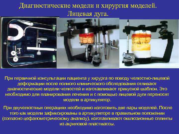 Диагностические модели и хирургия моделей. Лицевая дуга. При первичной консультации пациента у хирурга по