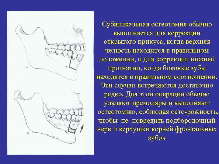 Задние положение