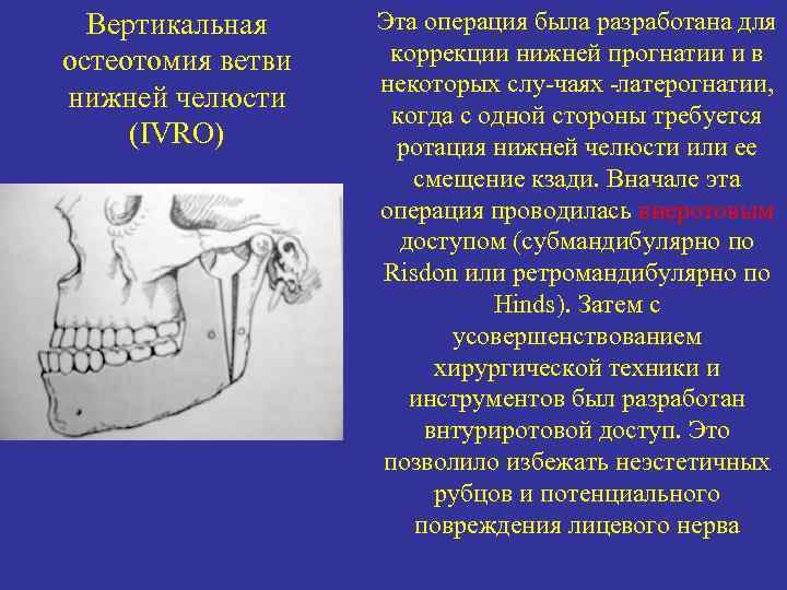 Основные методы операций для исправления размеров и формы нижней челюсти презентация