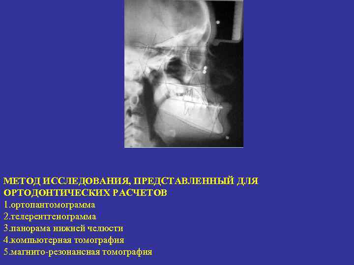 МЕТОД ИССЛЕДОВАНИЯ, ПРЕДСТАВЛЕННЫЙ ДЛЯ ОРТОДОНТИЧЕСКИХ РАСЧЕТОВ 1. ортопантомограмма 2. телерентгенограмма 3. панорама нижней челюсти