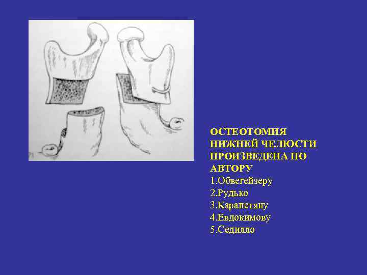 Схема рудько хирургическая стоматология