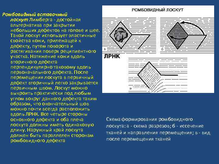 Треугольный лоскут. Ромбовидный лоскут Лимберга. Закрытие ромбовидного дефекта. Пластика ромбовидным лоскутом по Лимбергу.