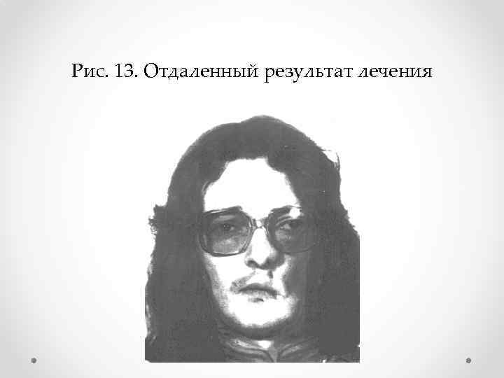 Рис. 13. Отдаленный результат лечения 