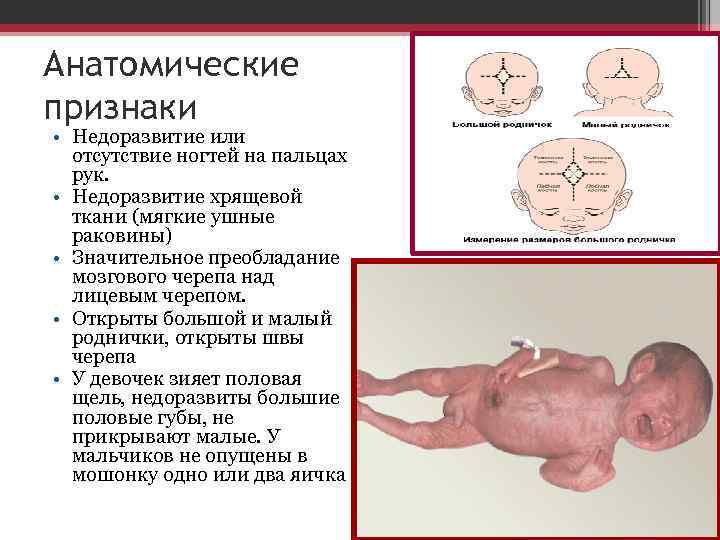 Анатомические признаки • Недоразвитие или отсутствие ногтей на пальцах рук. • Недоразвитие хрящевой ткани