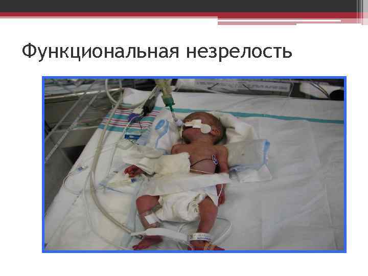 Функциональная незрелость 