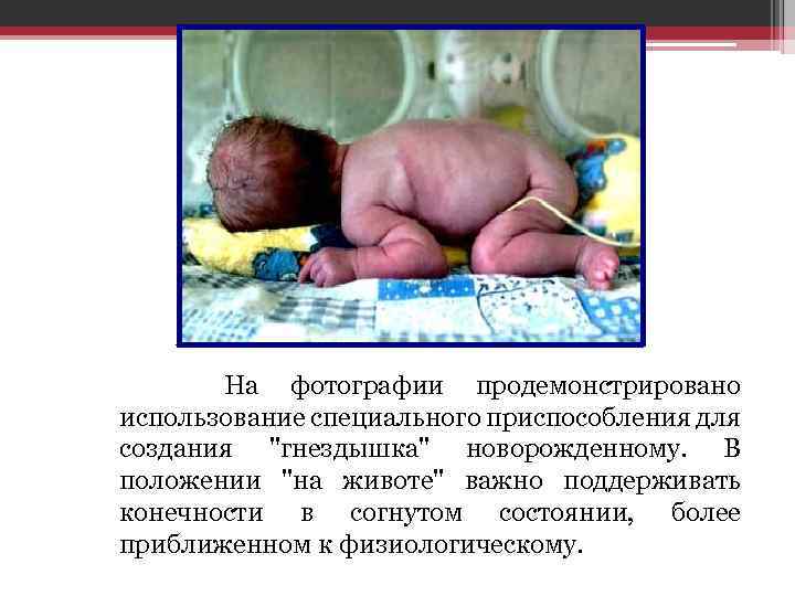  На фотографии продемонстрировано использование специального приспособления для создания 