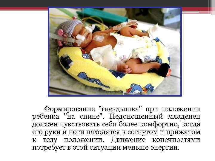  Формирование 