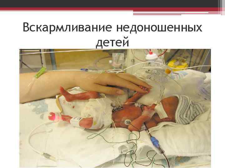 Вскармливание недоношенных детей 