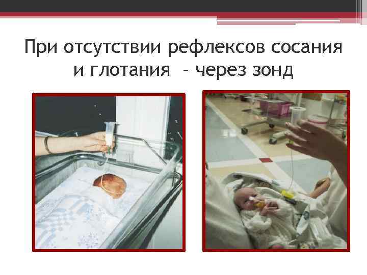 При отсутствии рефлексов сосания и глотания – через зонд 